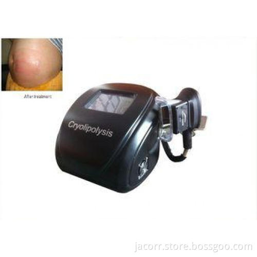 8 inch touch screen Cryolipolysis freeze fat cells , fat re